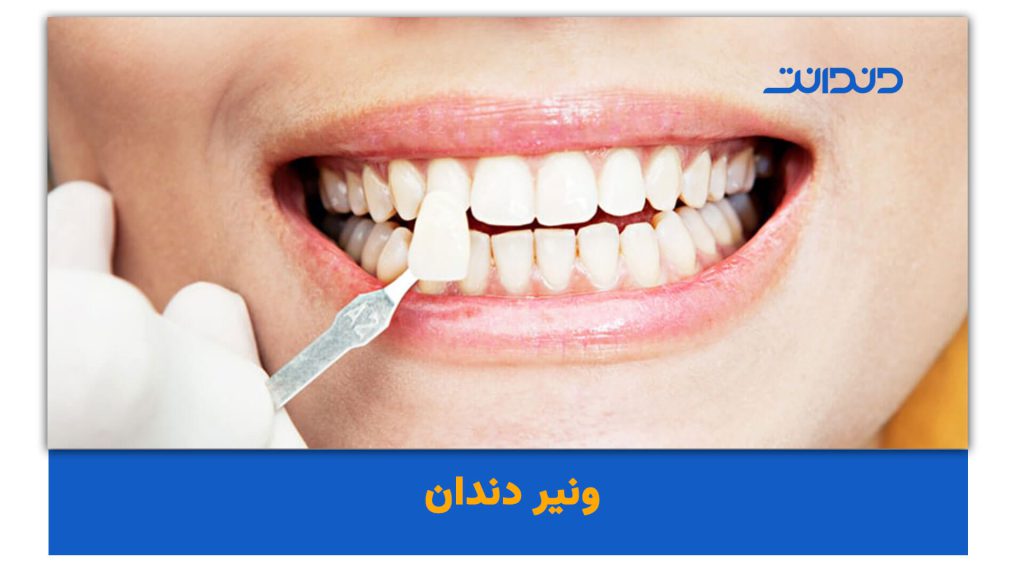 Khám Phá Thế Giới Giải Trí Trực Tuyến Với Phim Set Nhat Ban Hướng Dẫn Chi Tiết Và Kinh Nghiệm Cá Nhân